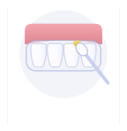 Encaixe nos dentes e tire o excesso
